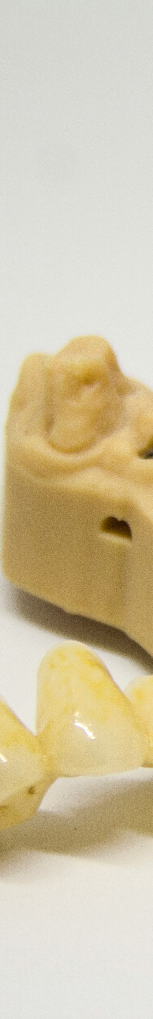 임플란트 후 관리의 중요성 관련 이미지 20