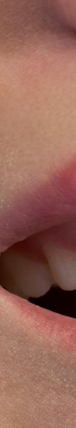 강남 무삭제라미네이트 치아깎지않는 개선방법 관련 이미지 9