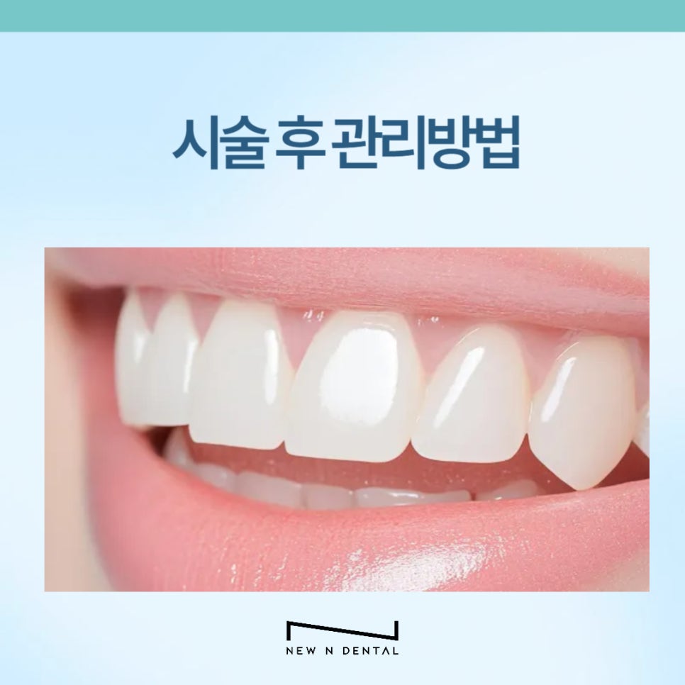 원데이 라미네이트 이런 분들께 추천드립니다 관련 이미지 9