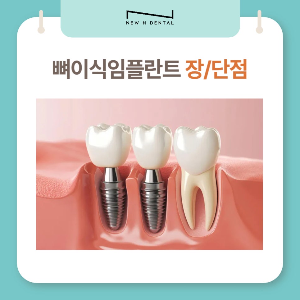 뼈이식임플란트, 잇몸뼈 부족 고민 완벽 해결 관련 이미지 7