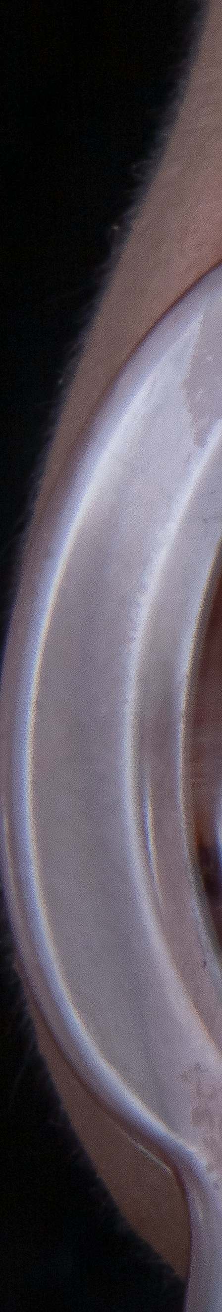 치아 미백 효과와 부작용 체크해야 할 사항 관련 이미지 18