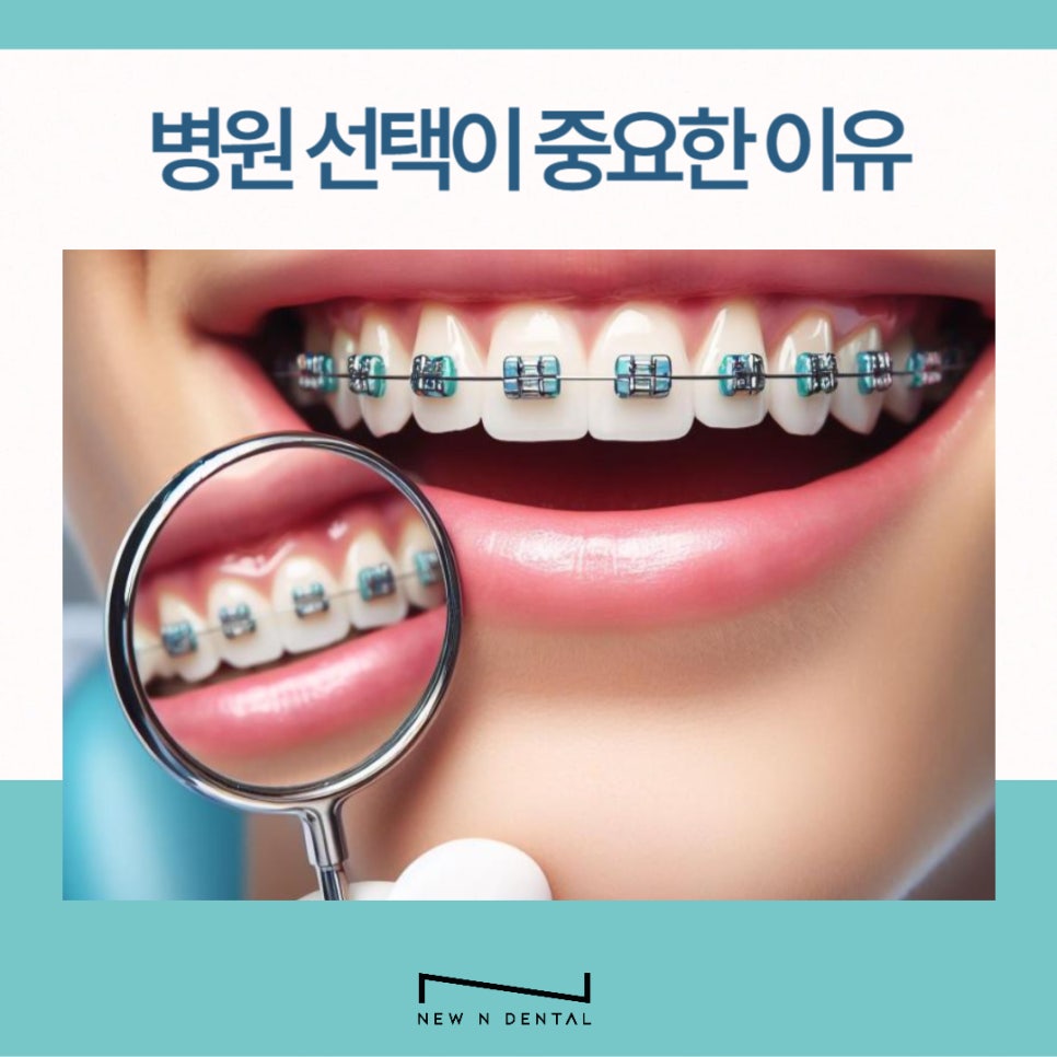 강남 돌출입치아교정 개선하려면 관련 이미지 8