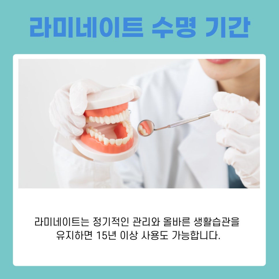 라미네이트 오래 유지하려면 알아야 할 점 관련 이미지 3