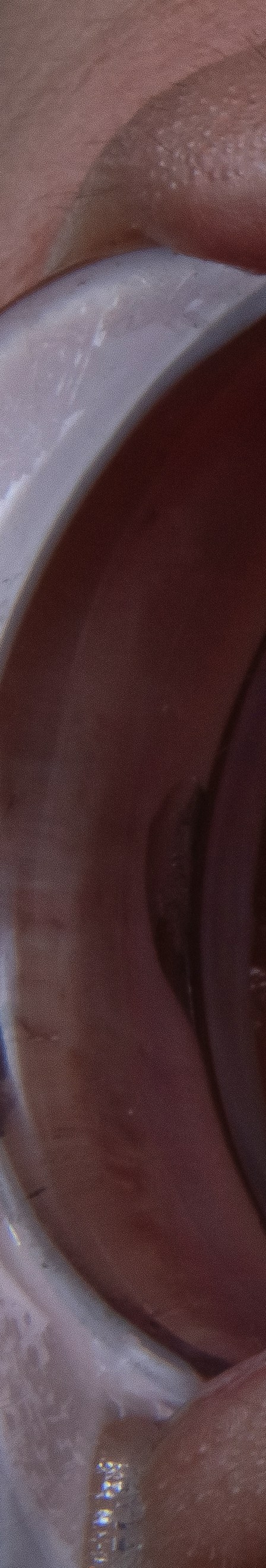 치아 미백 효과와 부작용 체크해야 할 사항 관련 이미지 19