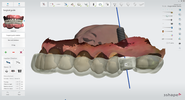 서초임플란트 경험과 디지털로 명확하게 관련 이미지 9