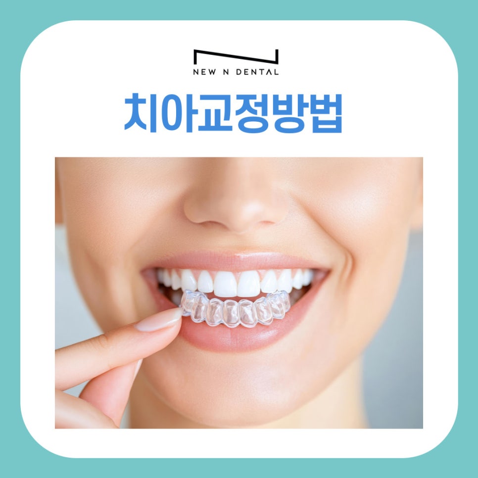 강남치아교정치과 치아교정방법, 디지털치아교정으로 더 정확하고 빠르게 관련 이미지 2