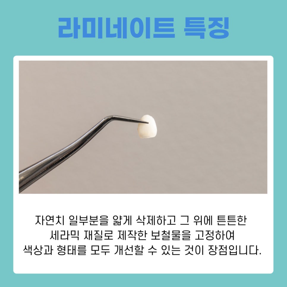 역삼동치과 라미네이트 하고 싶다면 어떤 점을 고려할까 관련 이미지 3