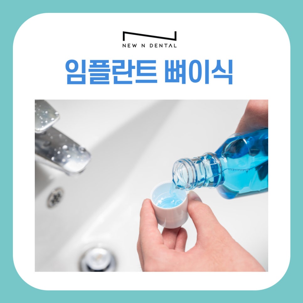 강남역치과 임플란트 뼈이식, 흡연과 음주가 미치는 영향은? 관련 이미지 8