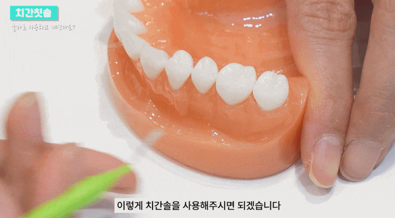 치간칫솔 치아관리 올바르게 사용하려면 관련 이미지 7