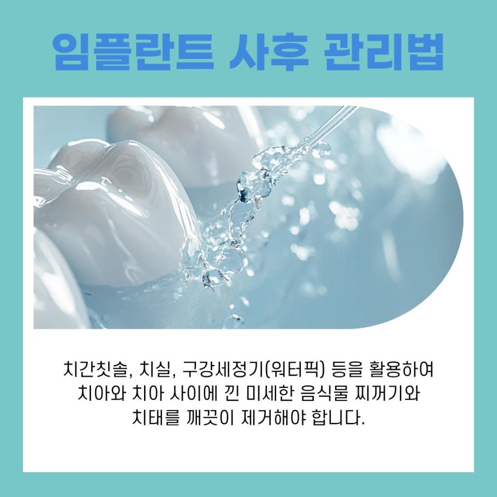 Management Methods to Prevent Peri-Implantitis After Implant Surgery at Sinnonhyeon Station image 9