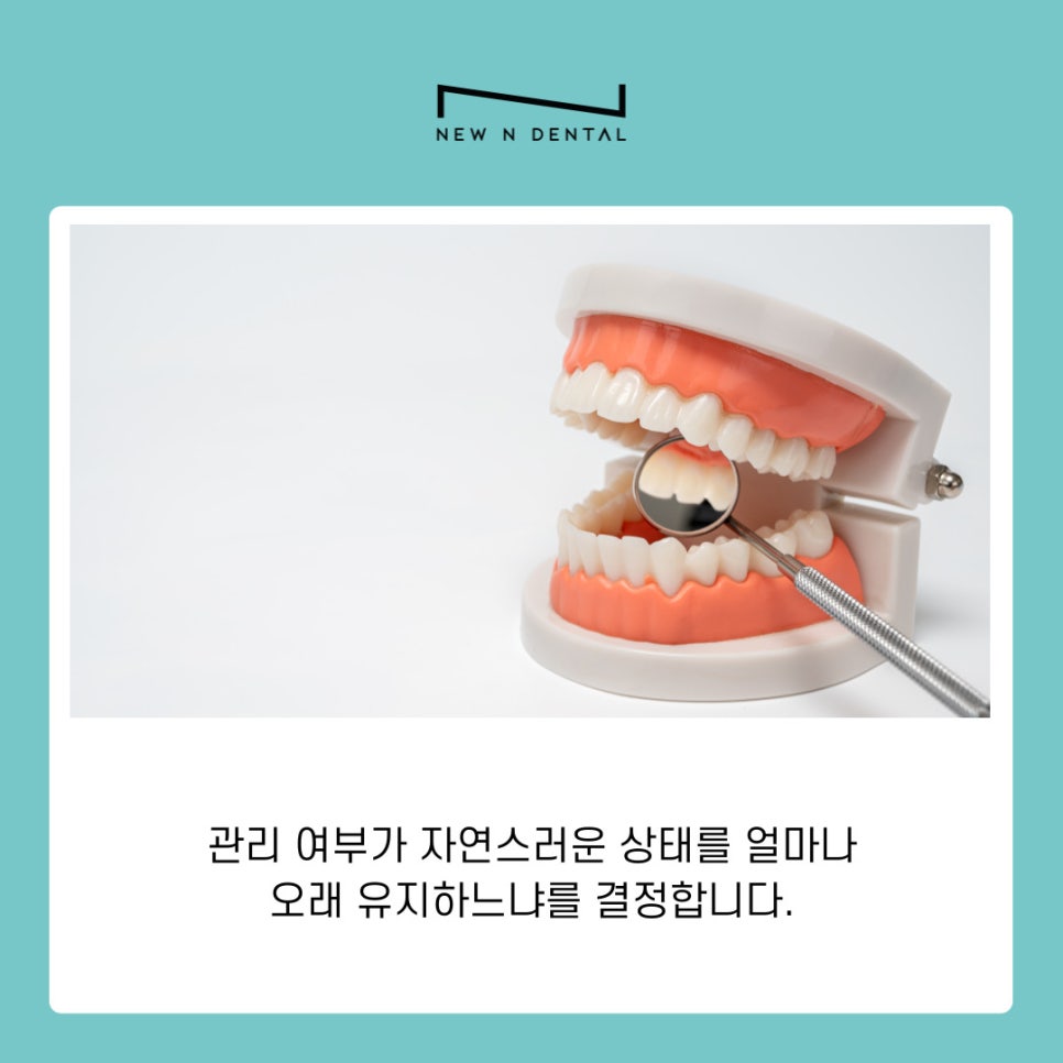 신사동 라미네이트 치과 무삭제 치아성형 자연스러운 변화 관련 이미지 6