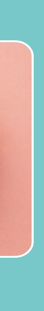 앞니 임플란트 식립 주의해야 할 사항은? 관련 이미지 17