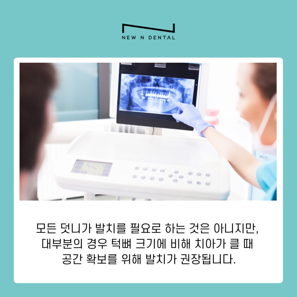 강남역교정치과 덧니발치교정 치아 건강과 심미성 모두 잡는 방법 관련 이미지 5