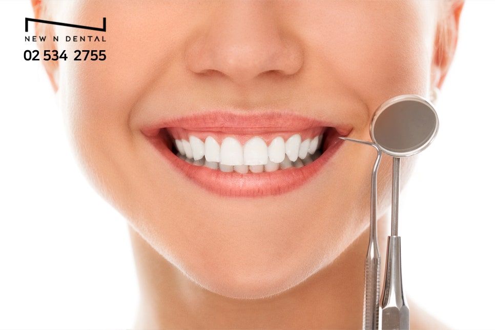 무삭제라미네이트가격 첫인상 가성비 좋은방법 관련 이미지 6