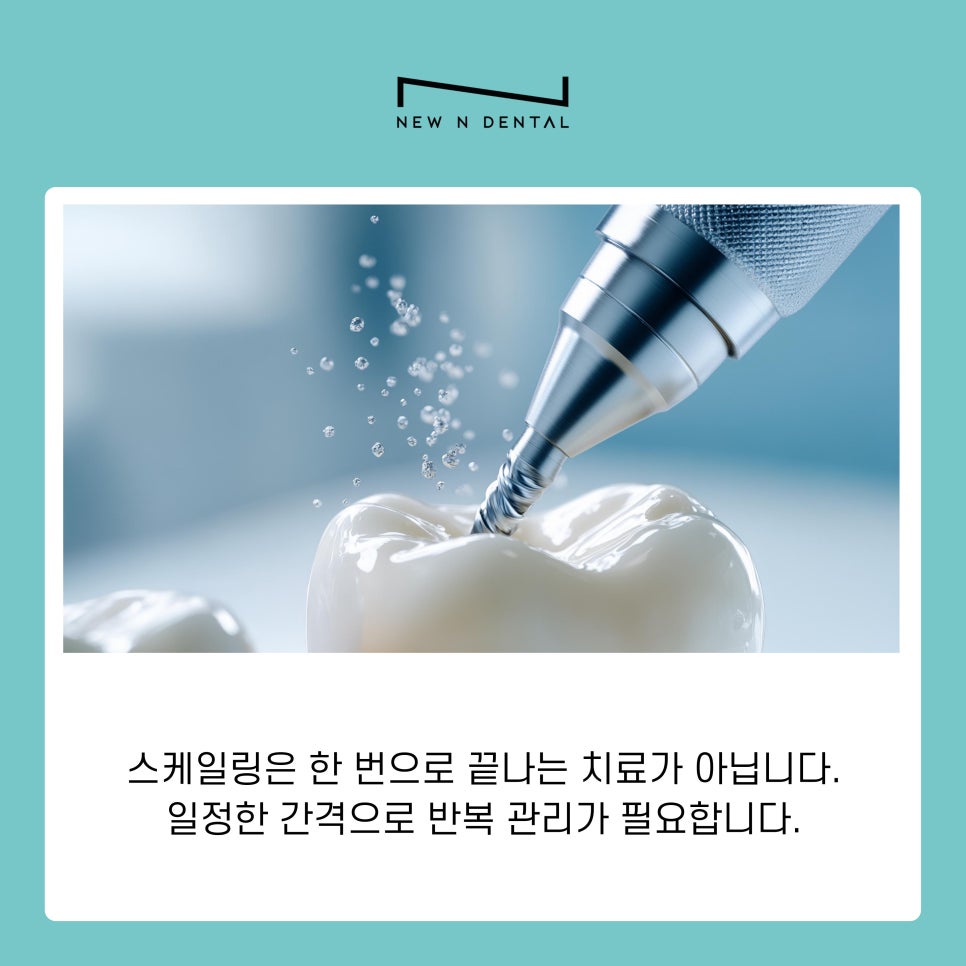 신사동 치과 스케일링후 관리 방법과 주의사항 관련 이미지 7