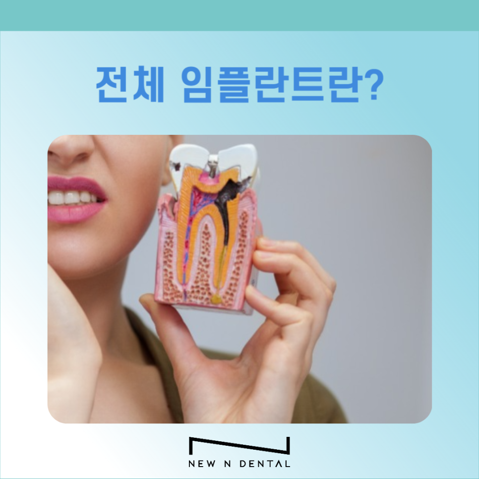 전체임플란트 시술 전 꼭 알아야 할 5가지 관련 이미지 3