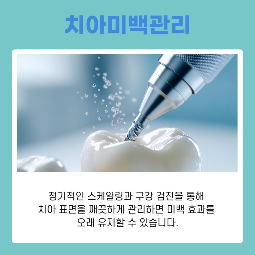 강남역치과 치아미백 원리부터 관리 방법 까지 관련 이미지 8
