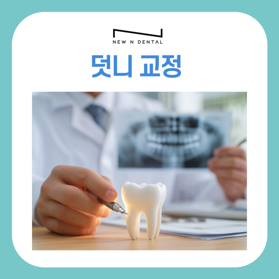 덧니 교정 발치 여부 어떻게 결정될까 관련 이미지 2
