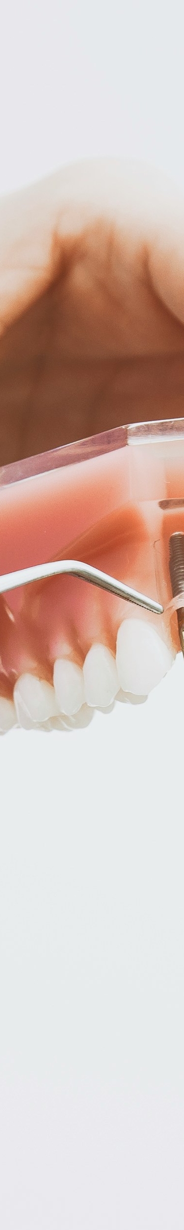 임플란트와 틀니 차이점, 나에게 맞는 선택은? 관련 이미지 19