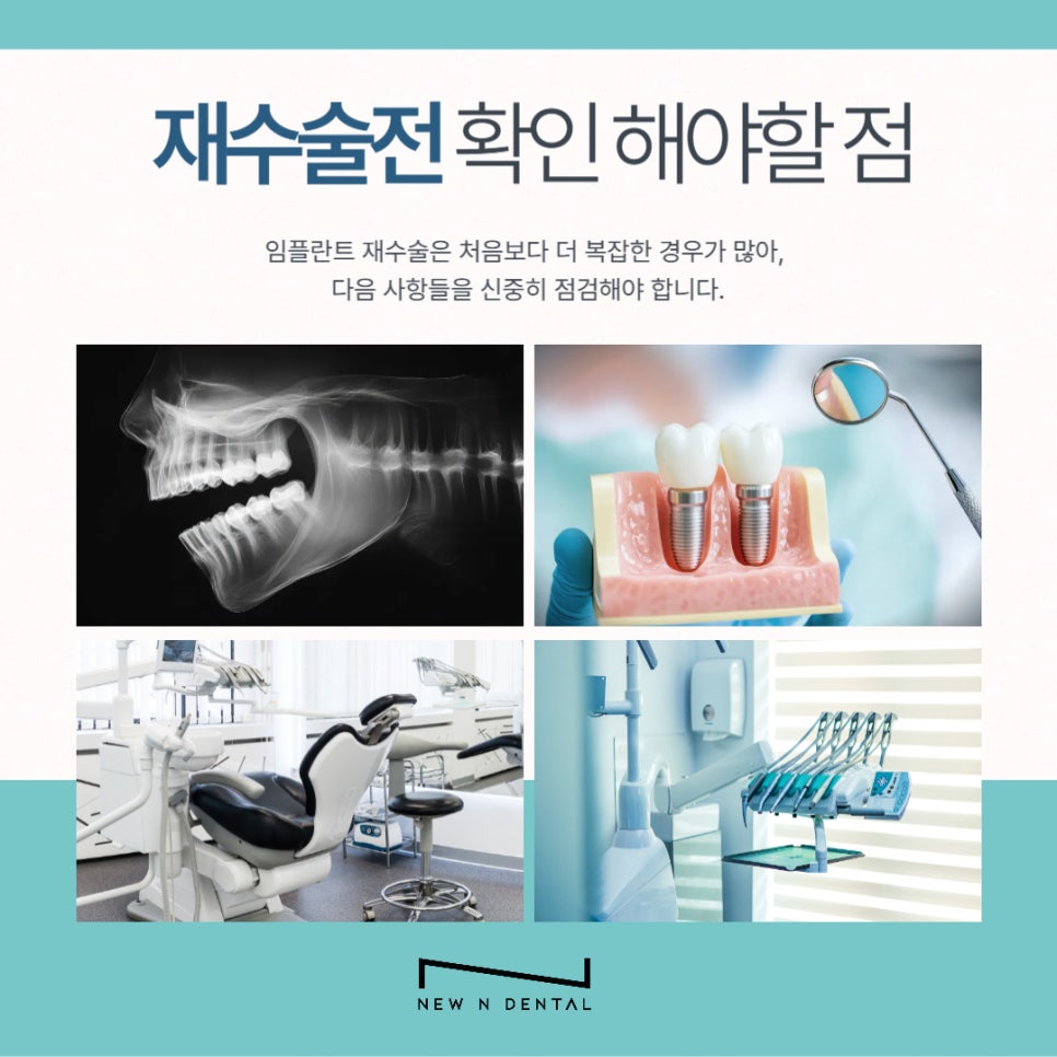 임플란트 재수술, 꼭 필요한 경우만 진행해야 합니다 관련 이미지 5