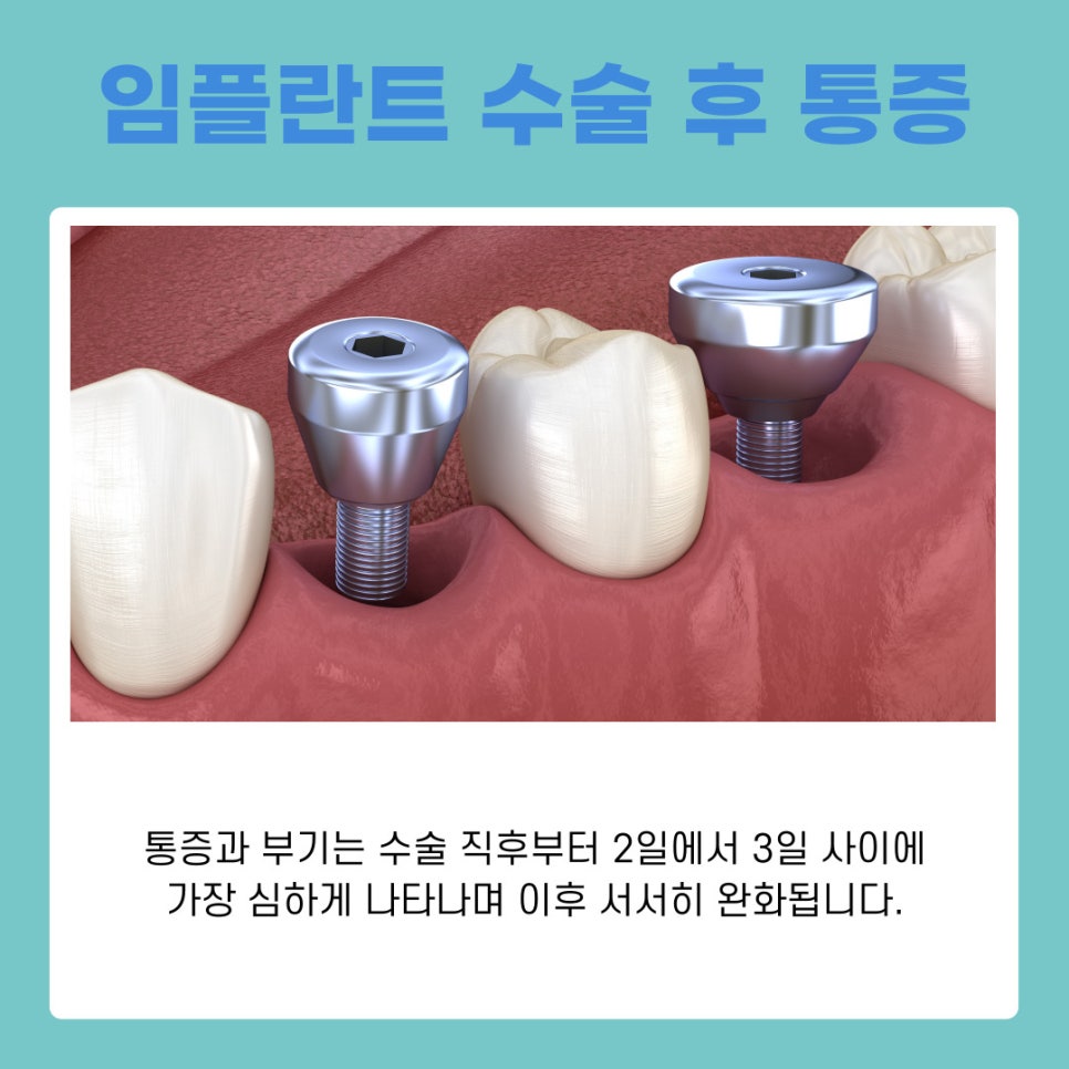 서초동임플란트치과와 함께하는 건강한 치아 회복과 관리 가이드 관련 이미지 9