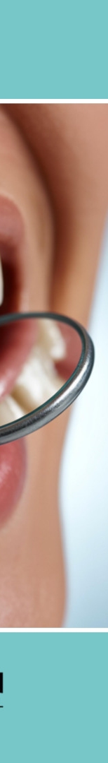 Seocho-dong Dental Clinic: Dental Regular Checkups and How to Prevent Cavities Properly image 14