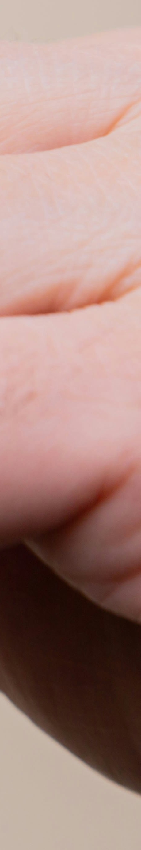 임플란트와 틀니 차이점, 나에게 맞는 선택은? 관련 이미지 33