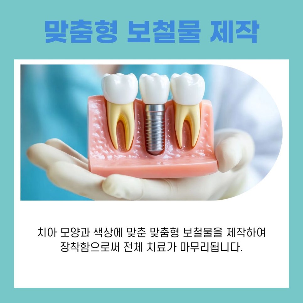 Management Methods to Prevent Peri-Implantitis After Implant Surgery at Sinnonhyeon Station image 7