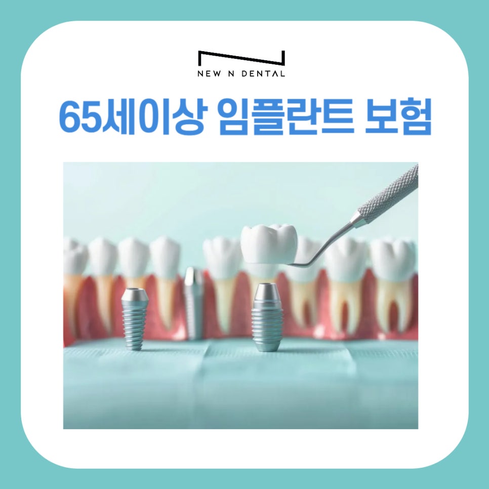 Gangnam Implant Costs for Those 65 and Older and Health Insurance Coverage Conditions image 1