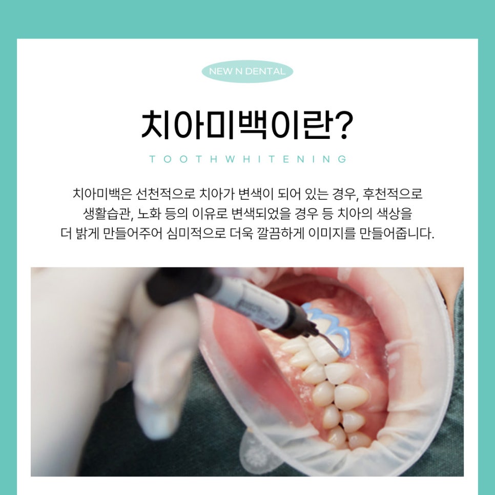 강남역미백치과가 전하는 치아미백의 모든 것 관련 이미지 2