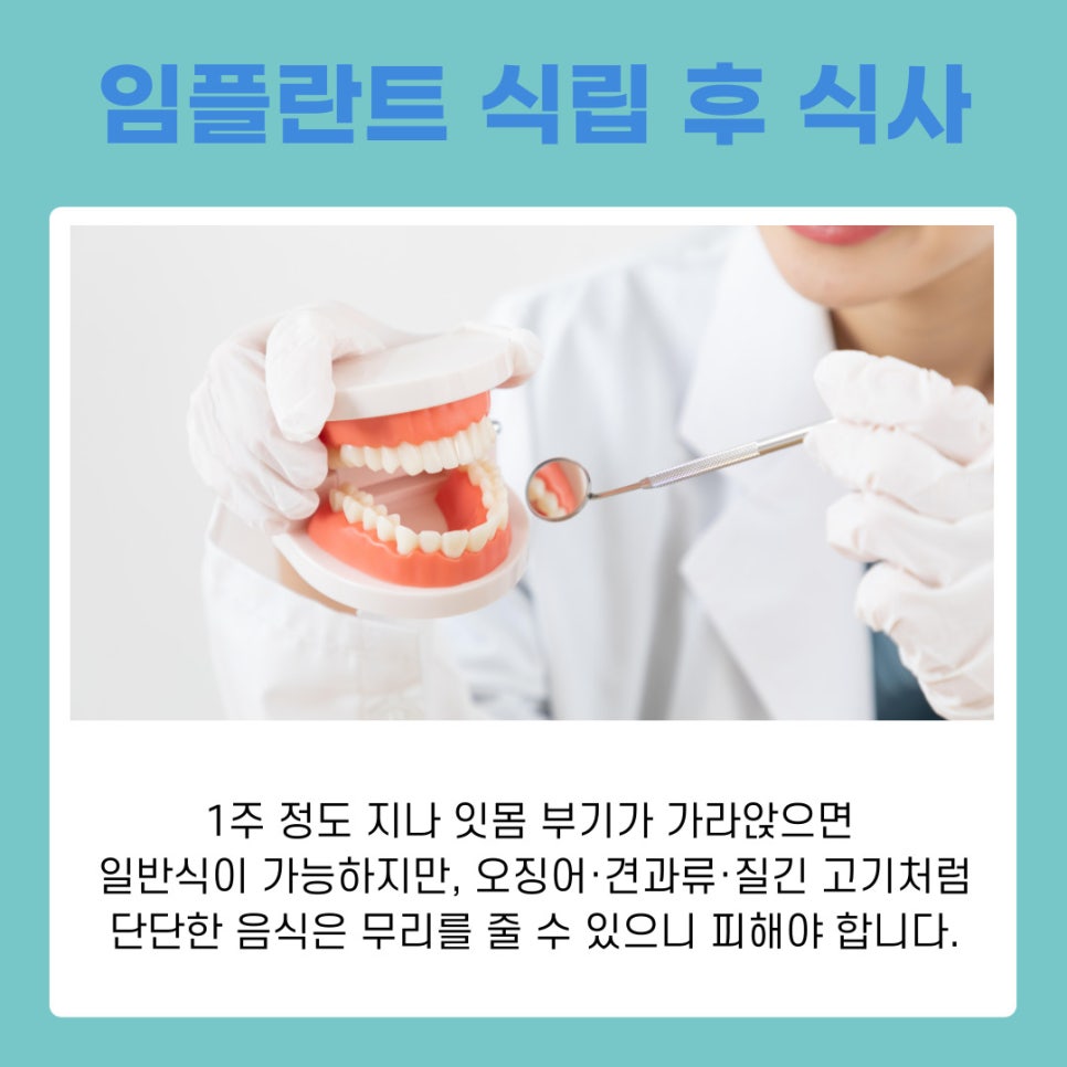 강남역치과 임플란트 식립 후 식사, 회복 과정 따라 달라지는 식단 팁 관련 이미지 6