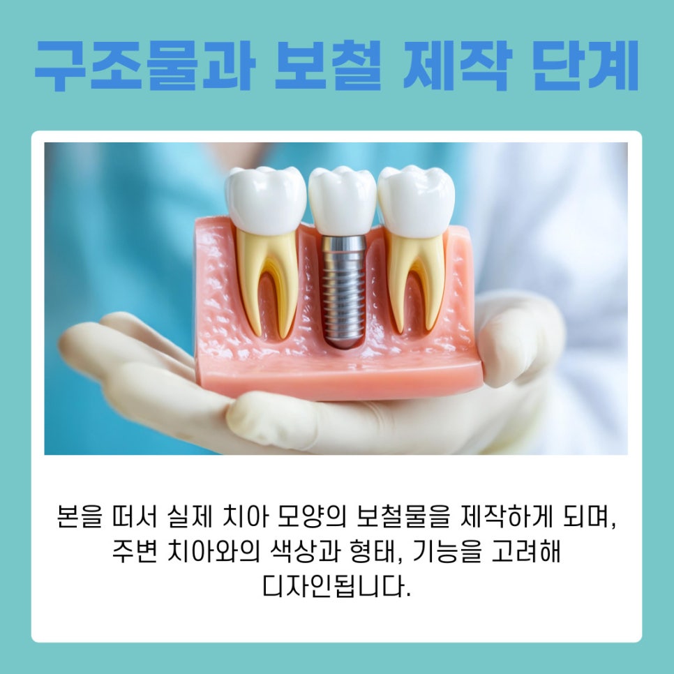 반포역치과 임플란트 치료 기간과 회복 과정 관련 이미지 7
