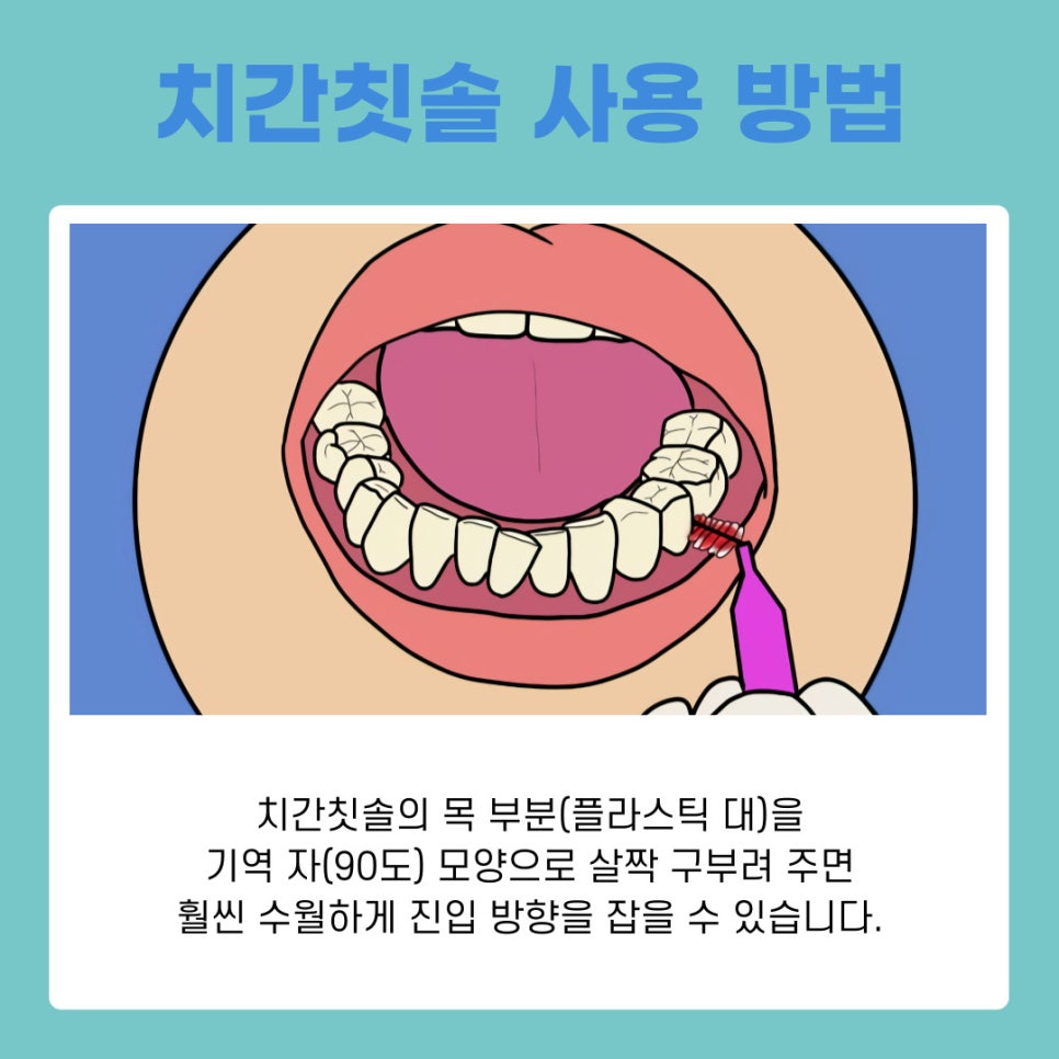 Interdental Brush Sizes: How to Choose the Right Size for Your Gums image 8