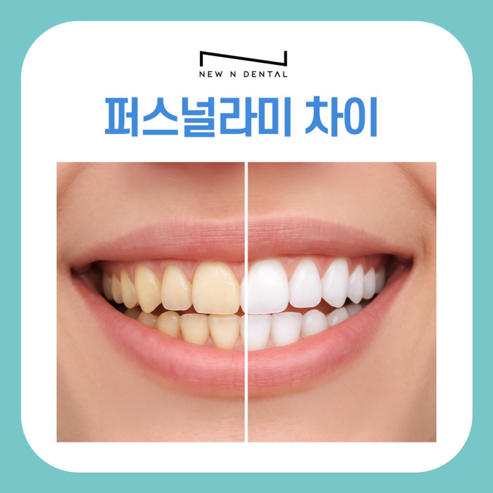 강남역치과 퍼스널라미 제로 네츄럴 차이 한눈에 관련 이미지 2