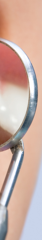 강남 무삭제라미네이트 치아깎지않는 개선방법 관련 이미지 16