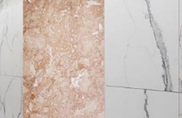 신논현역임플란트 건강하고 오래쓰는 임플란트 관련 이미지 25