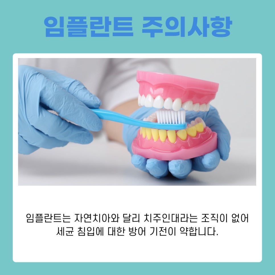 서초동임플란트치과와 함께하는 건강한 치아 회복과 관리 가이드 관련 이미지 6