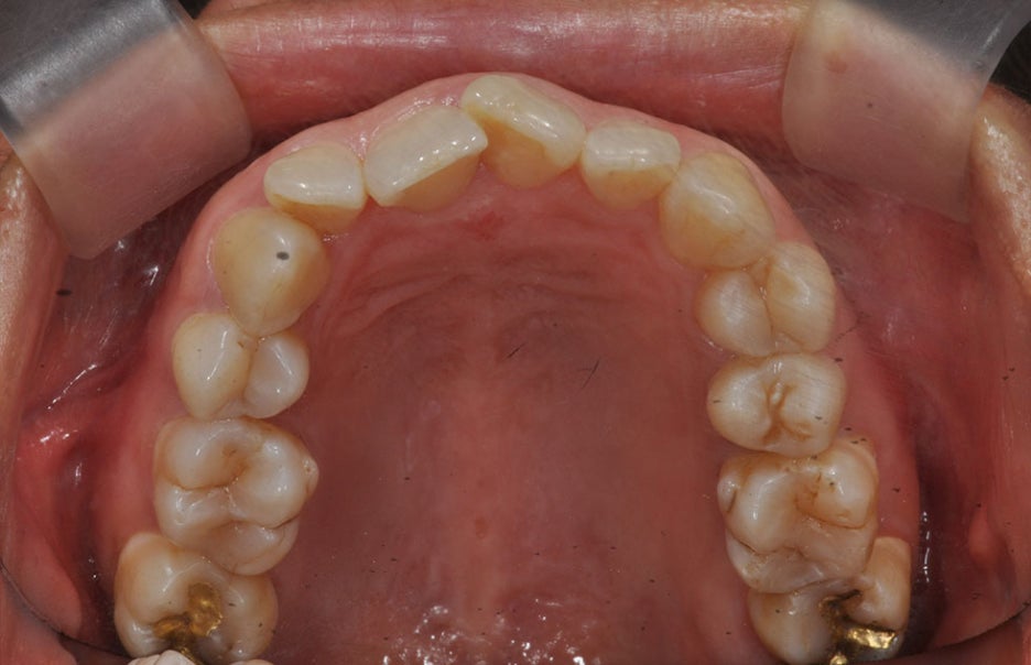 서울교정잘하는치과 컴퓨터분석 3D로 걱정없게 관련 이미지 4