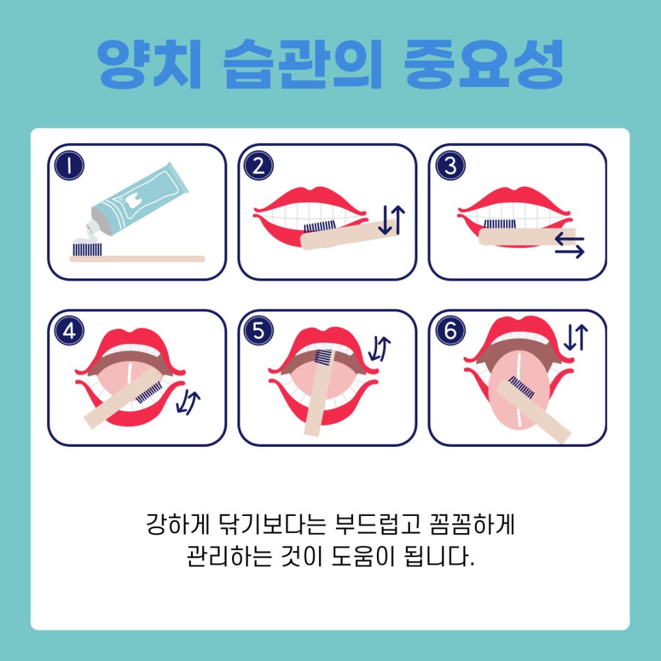 치아 미백 효과 유지 기간 늘리는 관리 방법 관련 이미지 4