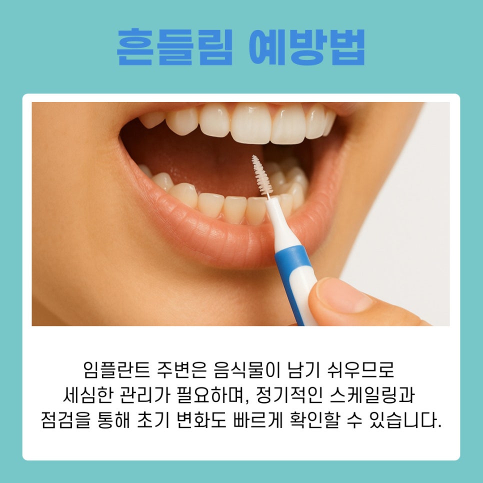 강남역임플란트치과 흔들림 발생 시 확인해야 할 원인과 대응법 관련 이미지 8