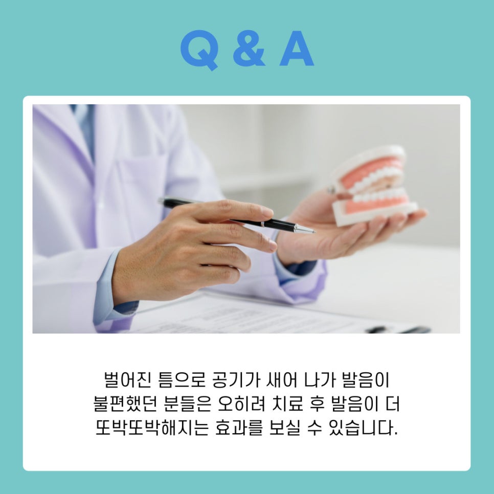 서초구치과에서 벌어진 앞니 교정 나에게 맞는 치료 알아보기 관련 이미지 8