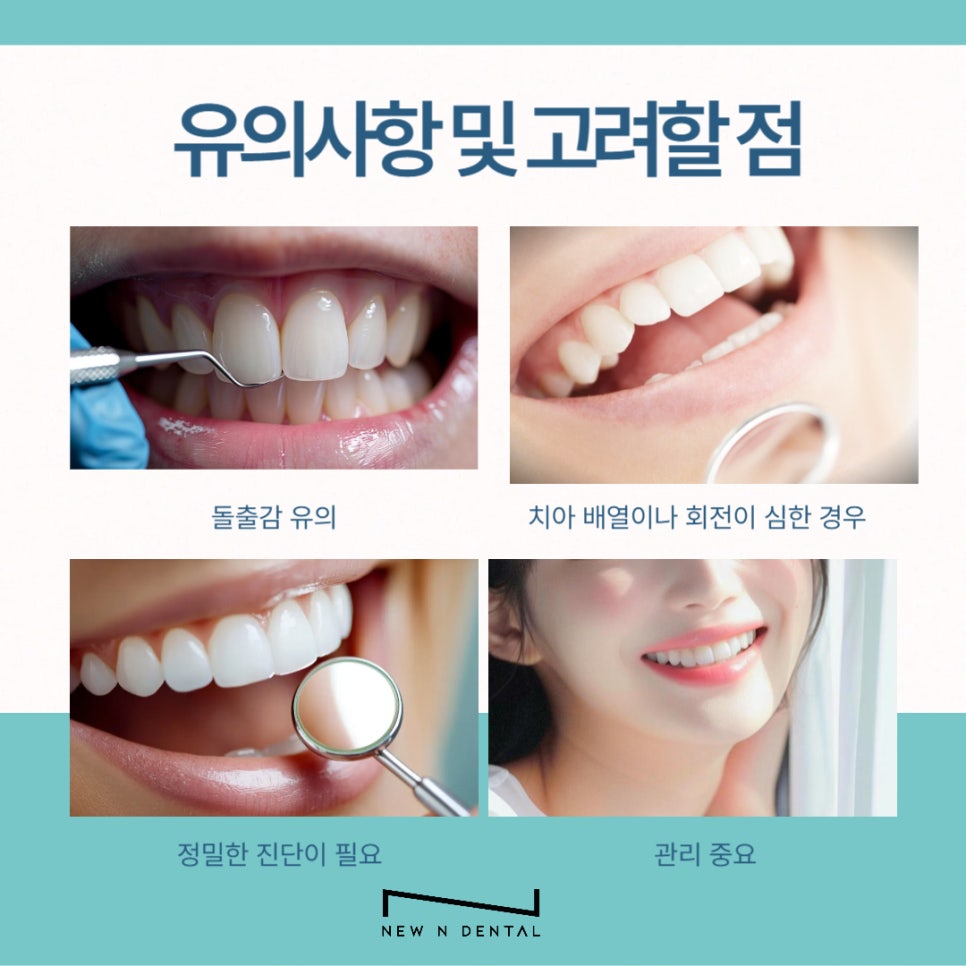 강남 무삭제라미네이트 치아깎지않는 개선방법 관련 이미지 7