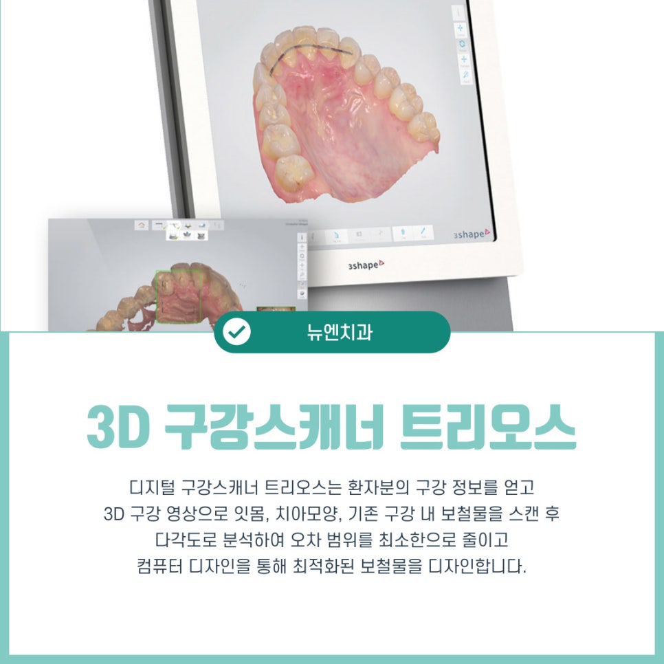 임플란트수술비용과 치료 과정에 대한 정보 관련 이미지 7