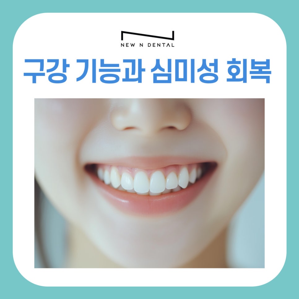 강남역 치과 전체임플란트 추천 어떤 분들이 대상일까? 관련 이미지 7