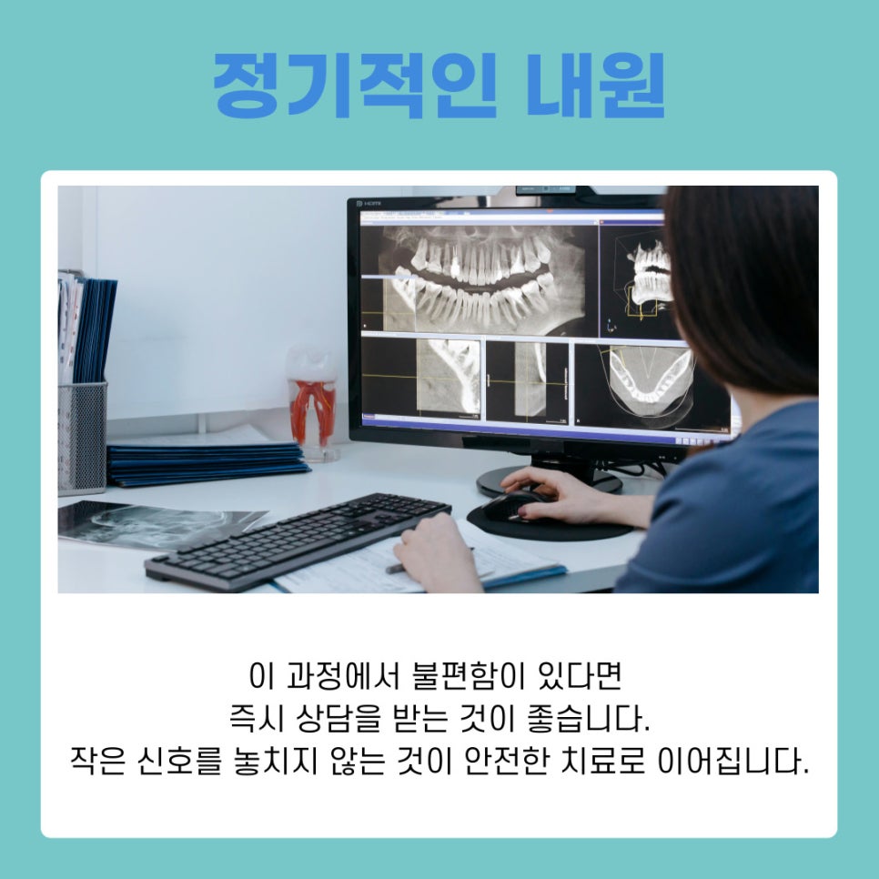 강남 역삼동 임플란트 뼈이식 과정과 회복 기간 이것만 알면 끝 관련 이미지 6
