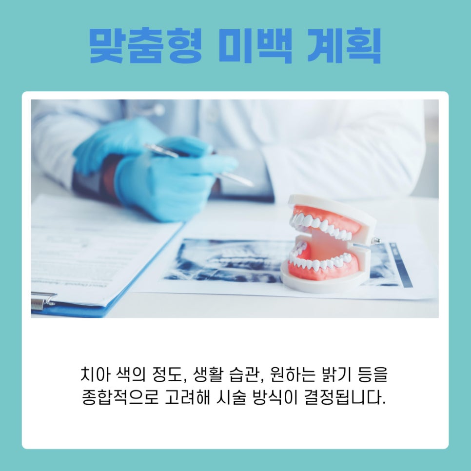 강남 신사동 치과에서 알려드리는 치아 미백 시술 과정 관련 이미지 4