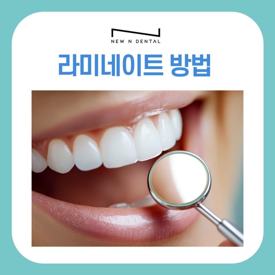강남역치과 라미네이트 방법, 단계별로 알아보기 관련 이미지 2