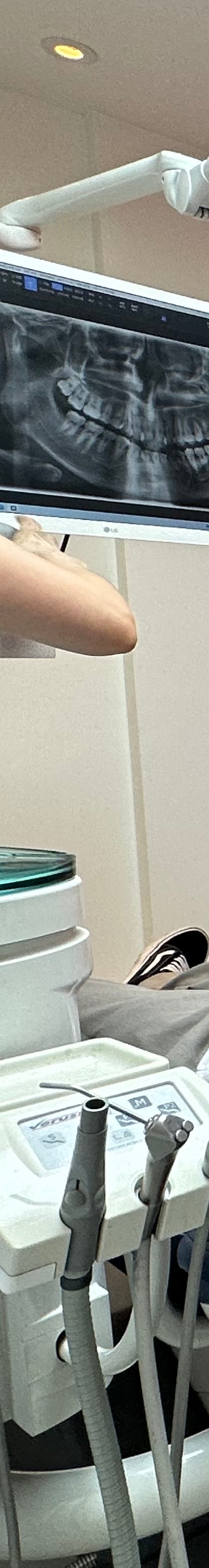 논현역치과 임플란트주위염 알아보기 관련 이미지 21