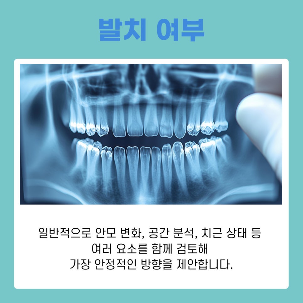 강남역교정치과 상담 받기 전 알아두면 유용한 교정 가이드 관련 이미지 5