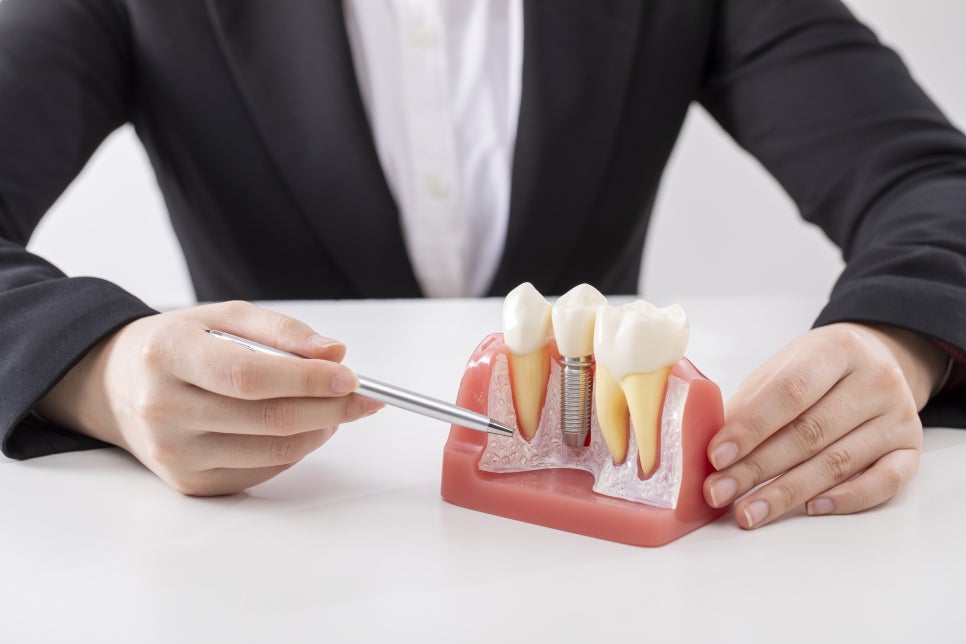 강남임플란트잘하는치과 찾는다면 관련 이미지 11